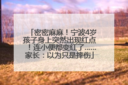 密密麻麻！宁波4岁孩子身上突然出现红点！连小便都变红了……家长：以为只是摔伤